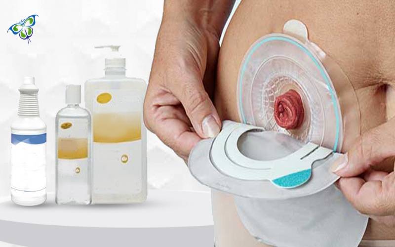 Cleaning of the Ostomy Appliance and The Skin Around Your Stoma