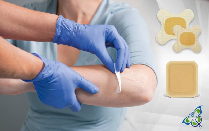Hydrocolloid Dressings - Composition & Applicability