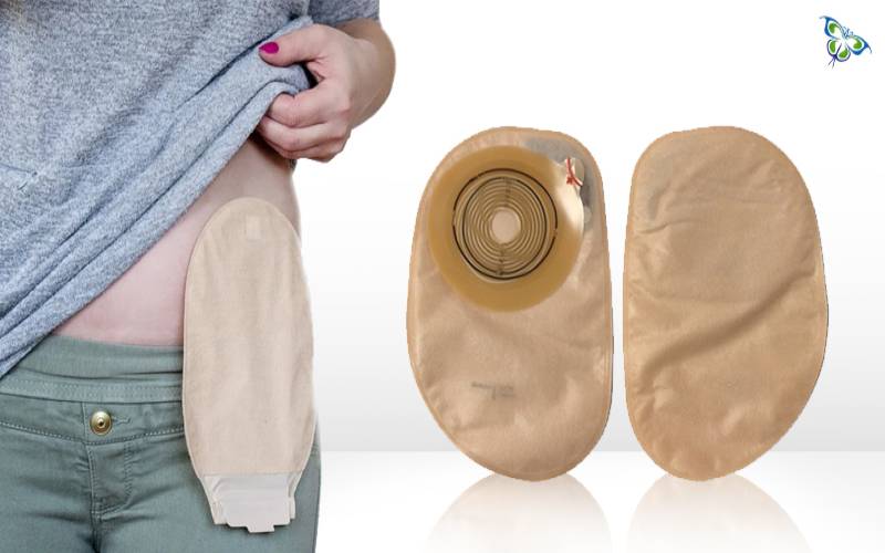 Is One-piece Closed Ostomy Pouch Right for me?