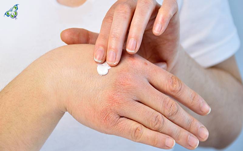 Types of Diabetic Skin Ailments & a Skincare Regime